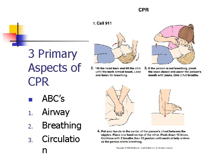 3 Primary Aspects of CPR n 1. 2. 3. ABC’s Airway Breathing Circulatio n