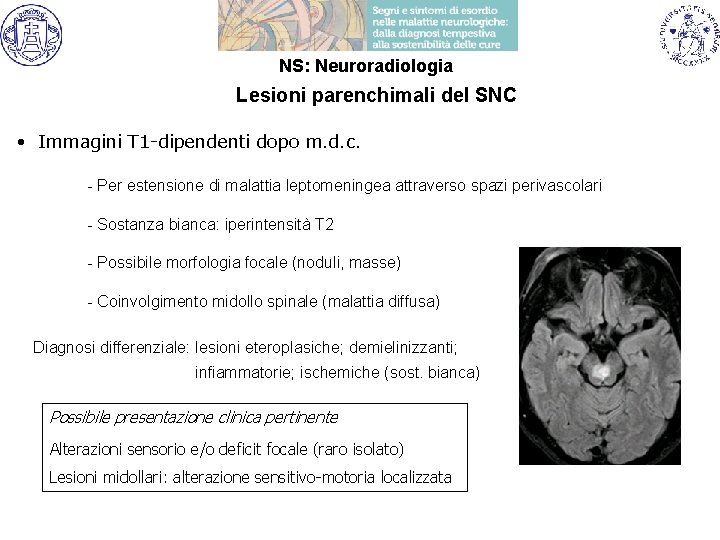 NS: Neuroradiologia Lesioni parenchimali del SNC • Immagini T 1 -dipendenti dopo m. d.