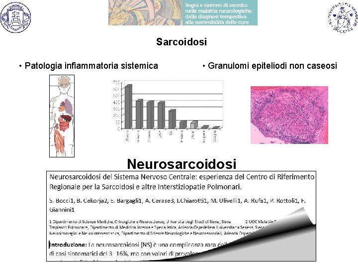 Sarcoidosi • Patologia infiammatoria sistemica • Granulomi epiteliodi non caseosi Neurosarcoidosi 