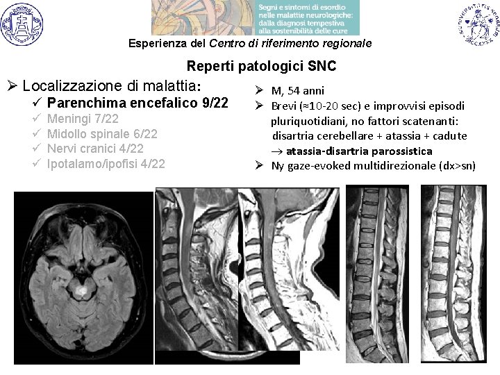 Esperienza del Centro di riferimento regionale Reperti patologici SNC Ø Localizzazione di malattia: ü