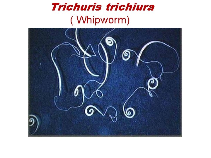 Trichuris trichiura ( Whipworm) 