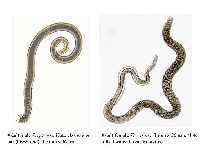 Adult male T. spiralis. Note claspers on tail (lower end). 1. 5 mm x