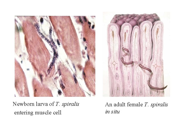Newborn larva of T. spiralis entering muscle cell An adult female T. spiralis in