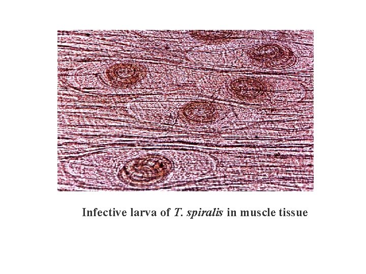 Infective larva of T. spiralis in muscle tissue 