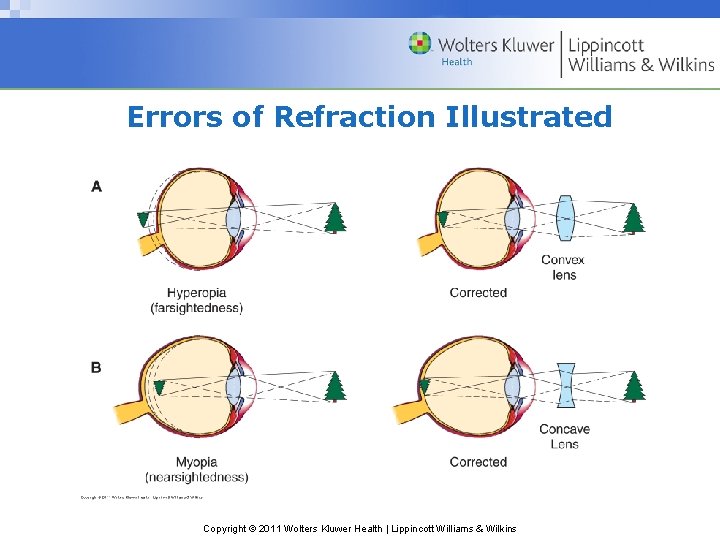 Errors of Refraction Illustrated Copyright © 2011 Wolters Kluwer Health | Lippincott Williams &