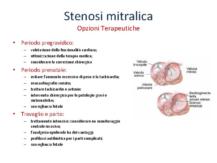 Stenosi mitralica Opzioni Terapeutiche • Periodo pregravidico: – valutazione della funzionalità cardiaca; – ottimizzazione