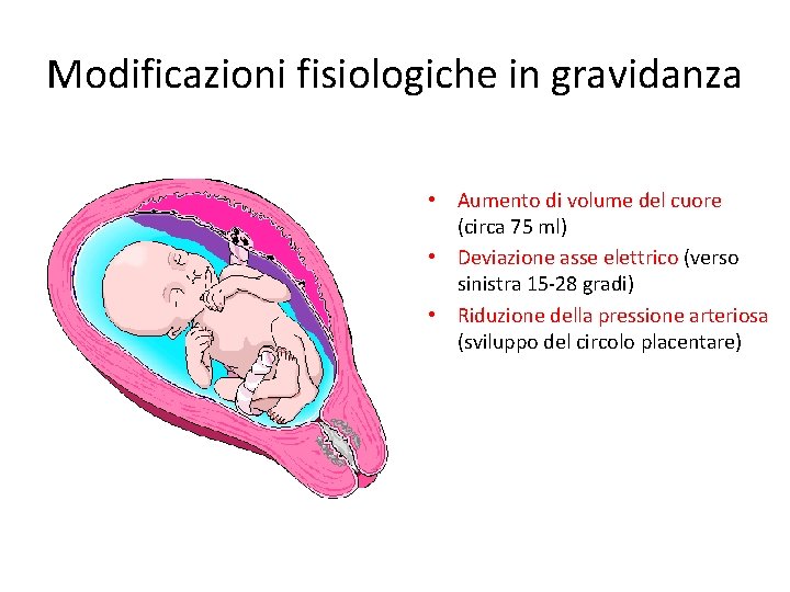 Modificazioni fisiologiche in gravidanza • Aumento di volume del cuore (circa 75 ml) •