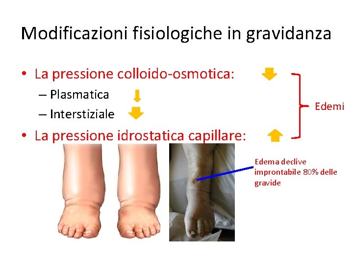 Modificazioni fisiologiche in gravidanza • La pressione colloido-osmotica: – Plasmatica – Interstiziale Edemi •