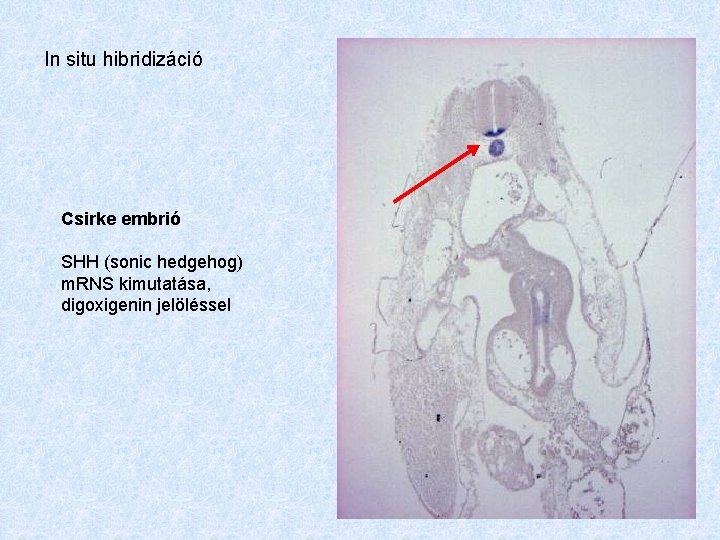 In situ hibridizáció Csirke embrió SHH (sonic hedgehog) m. RNS kimutatása, digoxigenin jelöléssel 