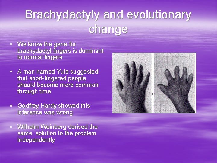 Brachydactyly and evolutionary change § We know the gene for brachydactyl fingers is dominant