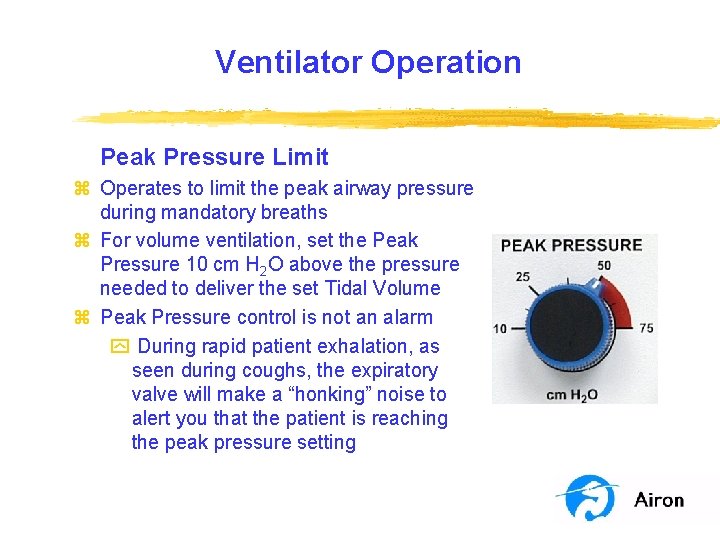 Ventilator Operation Peak Pressure Limit z Operates to limit the peak airway pressure during