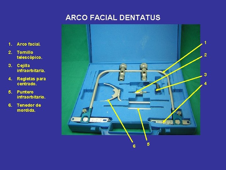 ARCO FACIAL DENTATUS 1. Arco facial. 1 2. Tornillo telescópico. 2 3. Cejilla infraorbitaria.