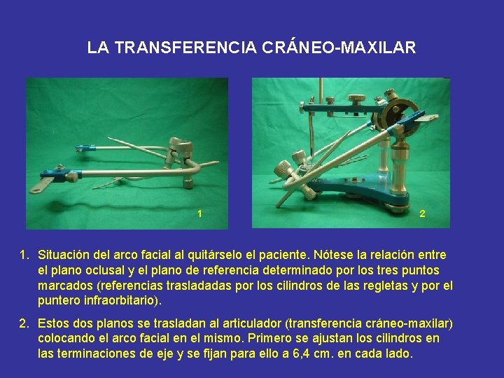 LA TRANSFERENCIA CRÁNEO-MAXILAR 1 2 1. Situación del arco facial al quitárselo el paciente.