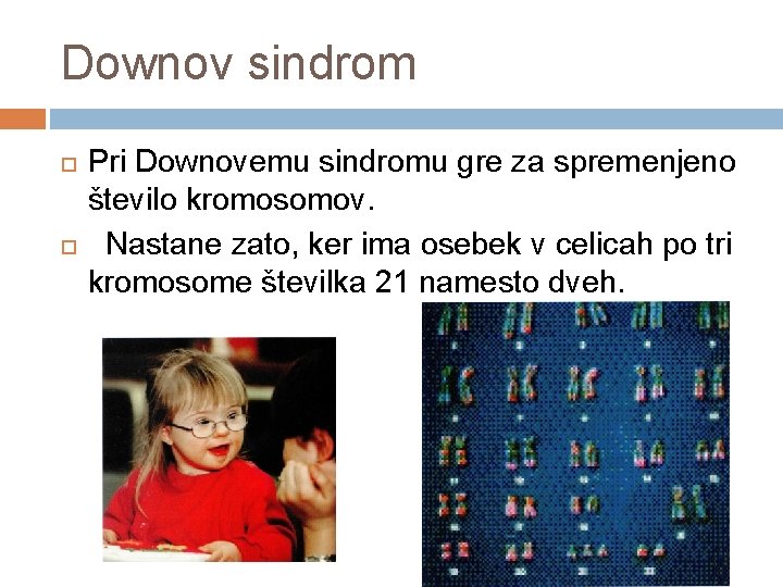 Downov sindrom Pri Downovemu sindromu gre za spremenjeno število kromosomov. Nastane zato, ker ima