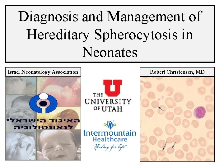 Diagnosis and Management of Hereditary Spherocytosis in Neonates Israel Neonatology Association Robert Christensen, MD
