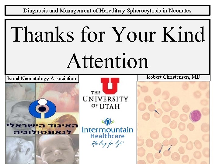 Diagnosis and Management of Hereditary Spherocytosis in Neonates Thanks for Your Kind Attention Israel