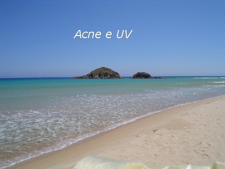 Acne e UV 