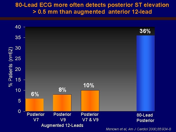 80 -Lead ECG more often detects posterior ST elevation > 0. 5 mm than