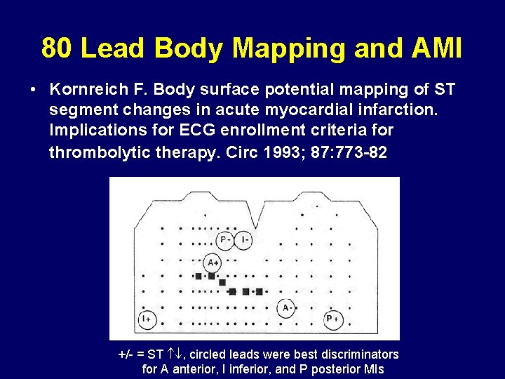 80 Lead Body Mapping and AMI • Kornreich F. Body surface potential mapping of