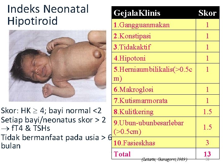 Indeks Neonatal Hipotiroid Gejala. Klinis 1. Gangguanmakan 2. Konstipasi 3. Tidakaktif 4. Hipotoni 5.