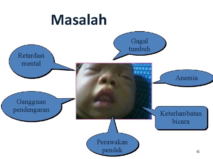 Masalah Gagal tumbuh Retardasi mental Anemia Gangguan pendengaran Keterlambatan bicara Perawakan pendek 41 