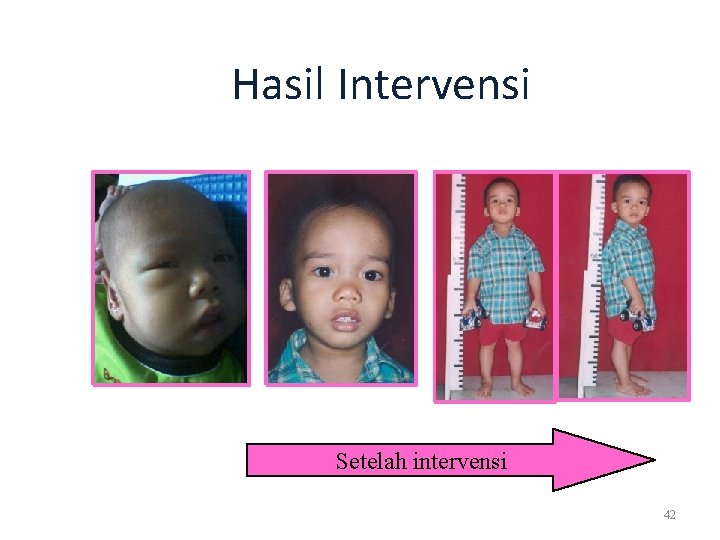 Hasil Intervensi Setelah intervensi 42 