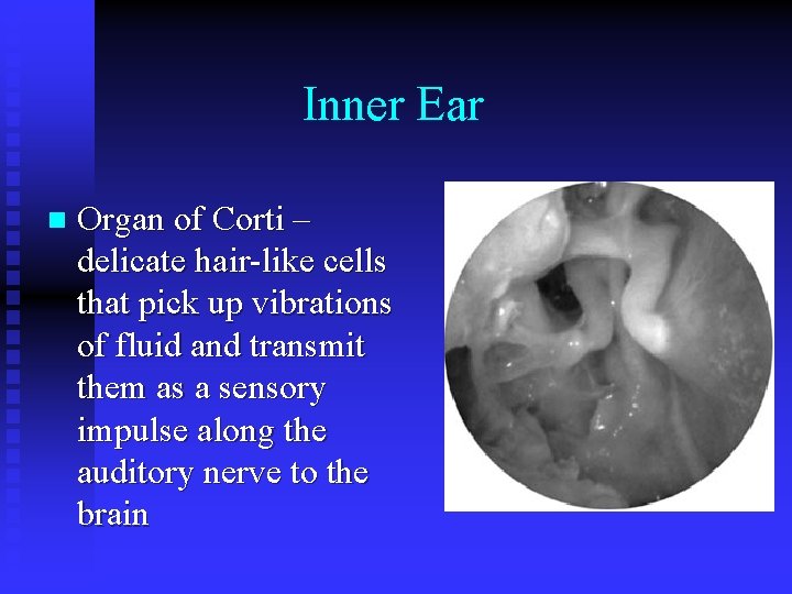 Inner Ear n Organ of Corti – delicate hair-like cells that pick up vibrations
