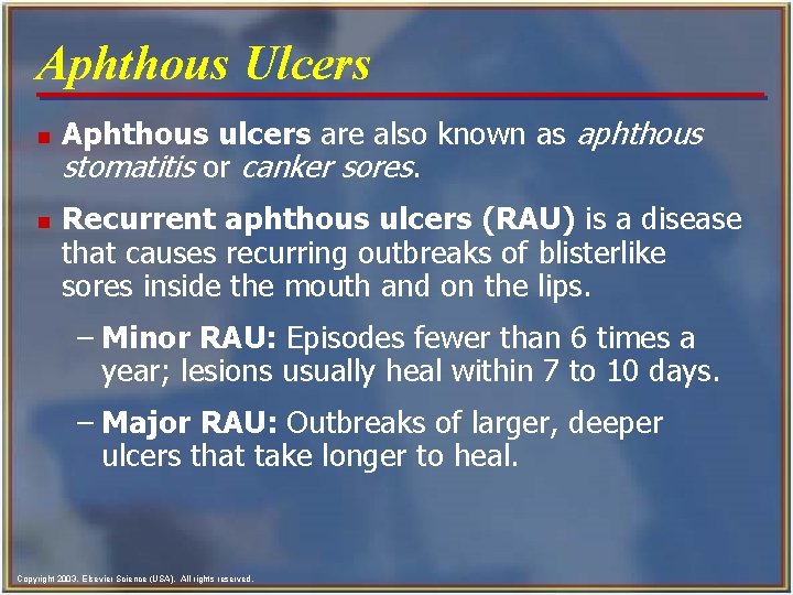 Aphthous Ulcers n n Aphthous ulcers are also known as aphthous stomatitis or canker