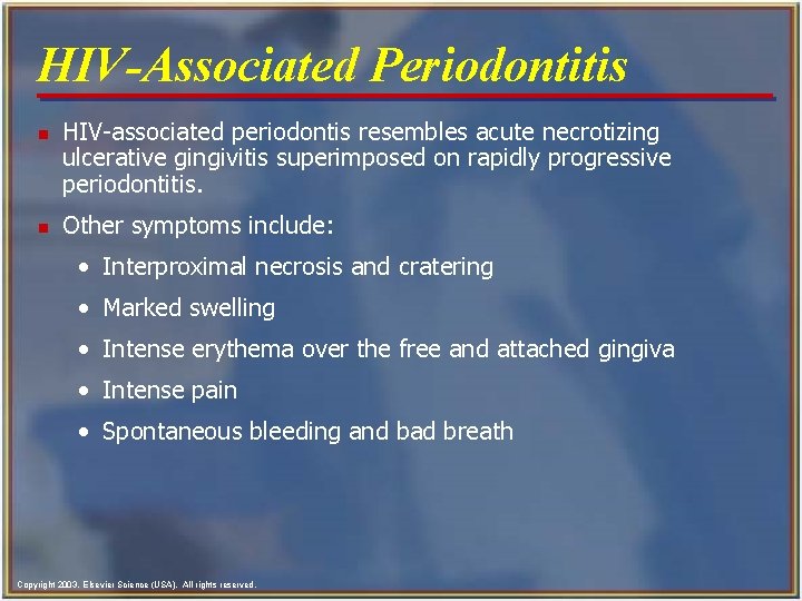 HIV-Associated Periodontitis n n HIV-associated periodontis resembles acute necrotizing ulcerative gingivitis superimposed on rapidly