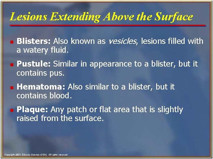 Lesions Extending Above the Surface n n Blisters: Also known as vesicles, lesions filled