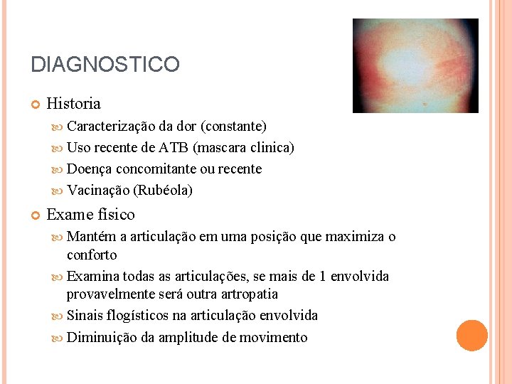 DIAGNOSTICO Historia Caracterização da dor (constante) Uso recente de ATB (mascara clinica) Doença concomitante