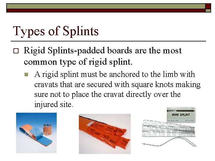 Types of Splints o Rigid Splints-padded boards are the most common type of rigid