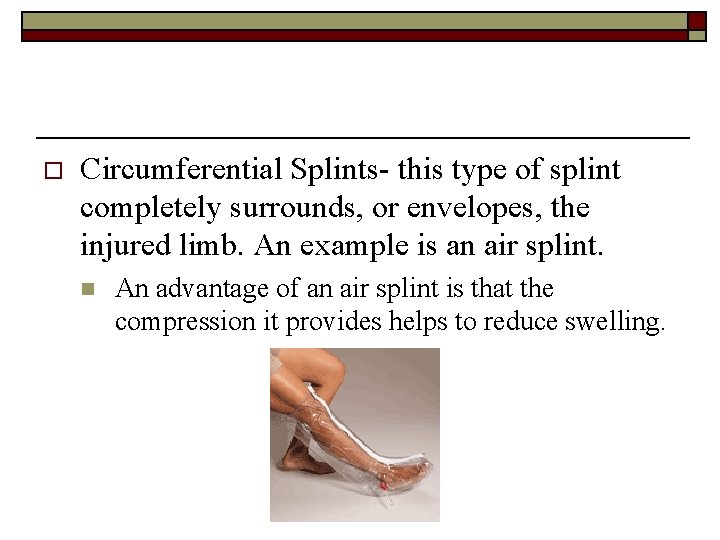 o Circumferential Splints- this type of splint completely surrounds, or envelopes, the injured limb.