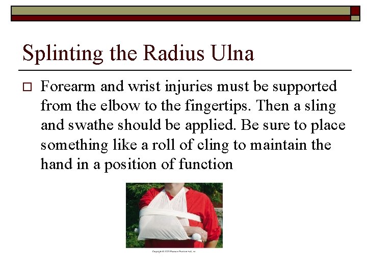 Splinting the Radius Ulna o Forearm and wrist injuries must be supported from the