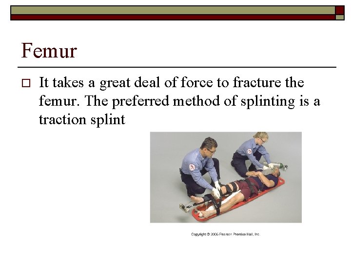 Femur o It takes a great deal of force to fracture the femur. The