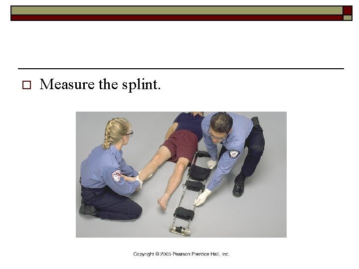 o Measure the splint. 