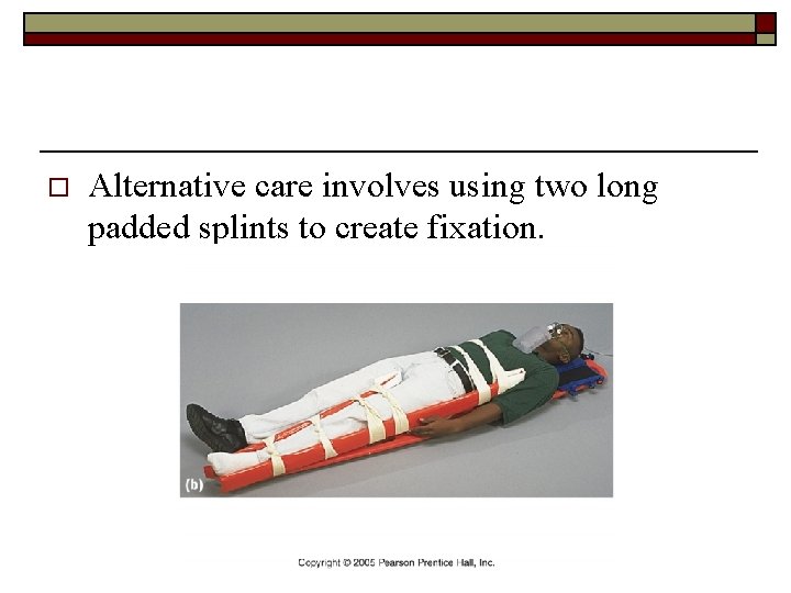 o Alternative care involves using two long padded splints to create fixation. 