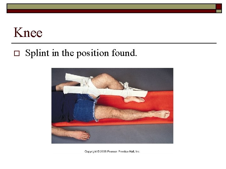 Knee o Splint in the position found. 