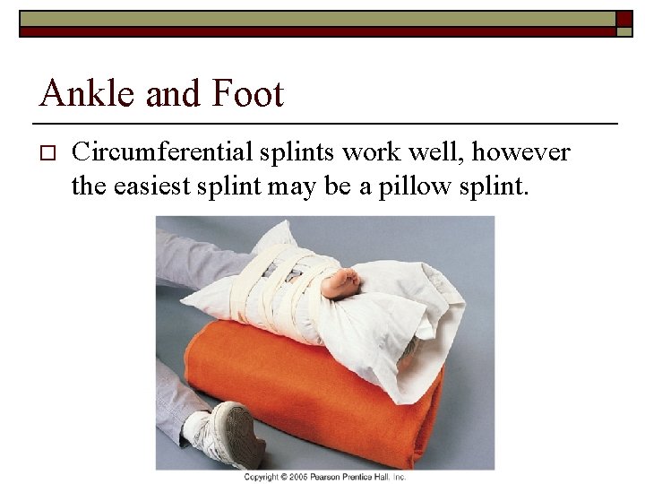 Ankle and Foot o Circumferential splints work well, however the easiest splint may be