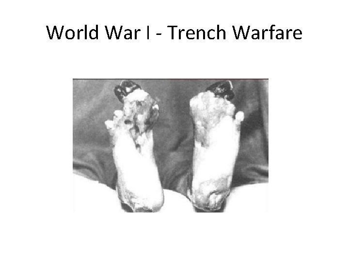 World War I - Trench Warfare 