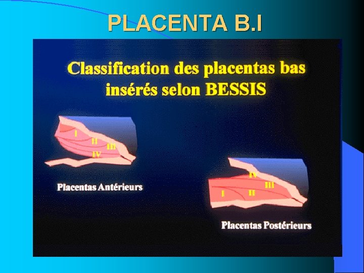PLACENTA B. I PLACENTA B. I