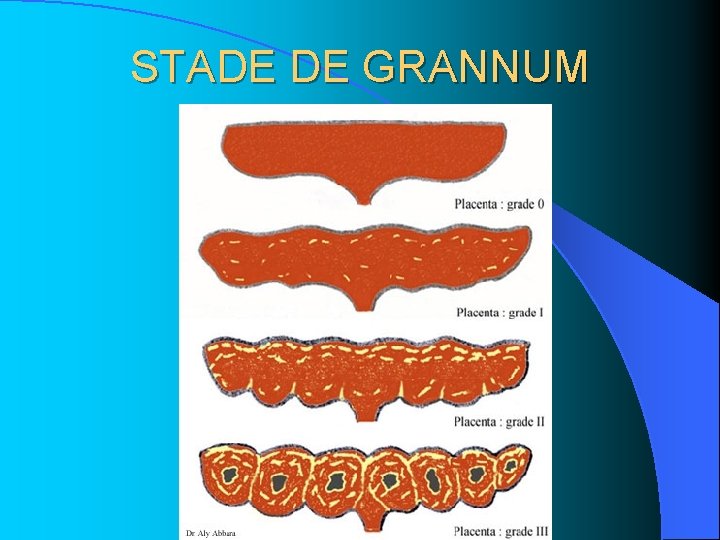 STADE DE GRANNUM STADE DE GRANNUM