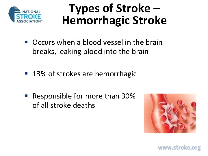 Types of Stroke – Hemorrhagic Stroke § Occurs when a blood vessel in the Types of Stroke – Hemorrhagic Stroke § Occurs when a blood vessel in the