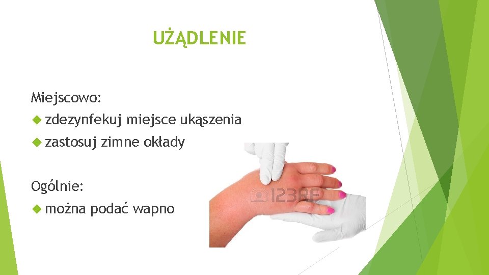 UŻĄDLENIE Miejscowo: zdezynfekuj zastosuj miejsce ukąszenia zimne okłady Ogólnie: można podać wapno 