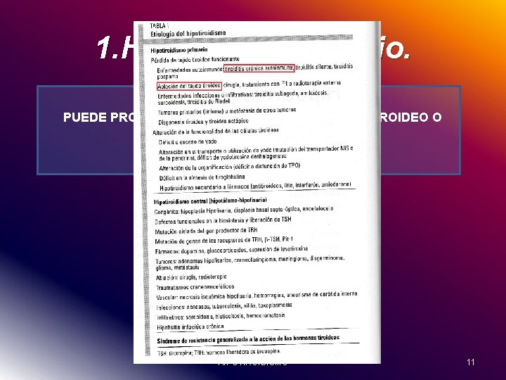 1. Hipotiroidismo 1 rio. PUEDE PRODUCIRSE POR PERDIDA DEL TEJIDO TIROIDEO O ALTERACION DE