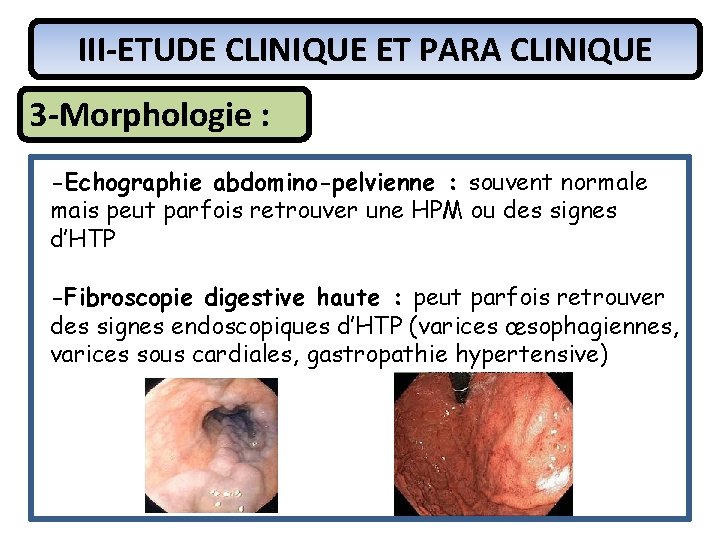III-ETUDE CLINIQUE ET PARA CLINIQUE 3 -Morphologie : -Echographie abdomino-pelvienne : souvent normale mais