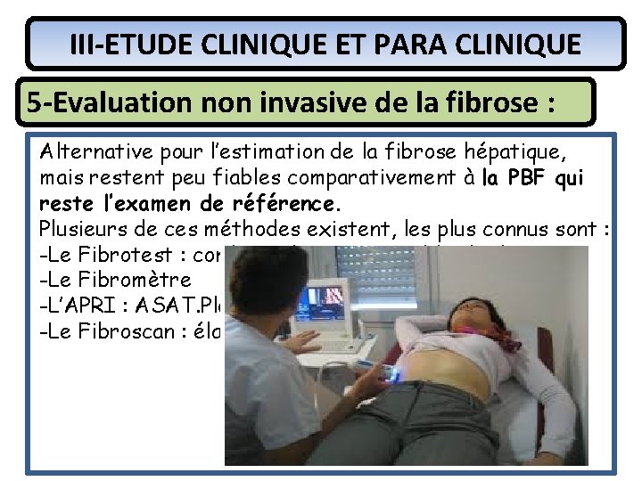 III-ETUDE CLINIQUE ET PARA CLINIQUE 5 -Evaluation non invasive de la fibrose : Alternative