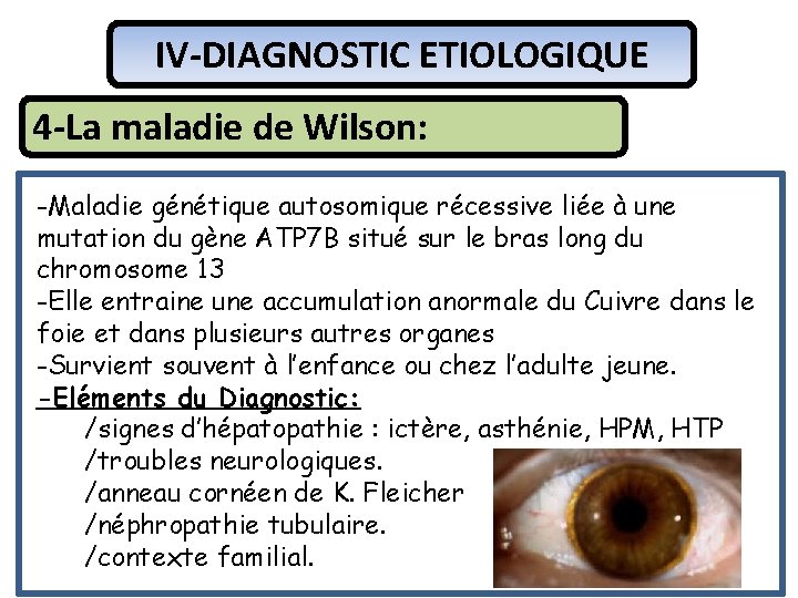 IV-DIAGNOSTIC ETIOLOGIQUE 4 -La maladie de Wilson: -Maladie génétique autosomique récessive liée à une