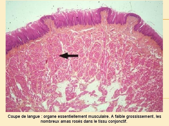 Coupe de langue : organe essentiellement musculaire. A faible grossissement, les nombreux amas rosés