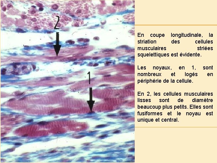 En coupe longitudinale, la striation des cellules musculaires striées squelettiques est évidente. Les noyaux,
